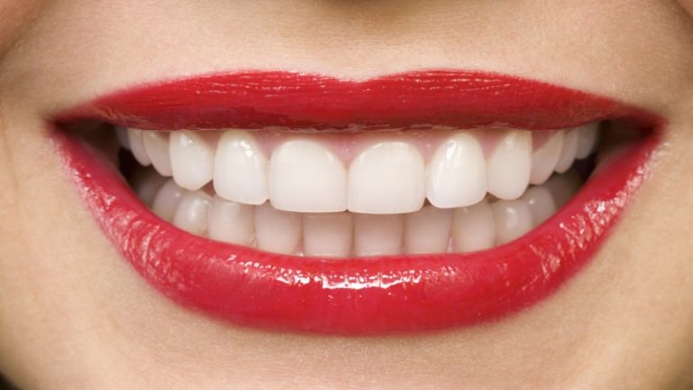 Why yellow teeth are put on and what to do to avoid it