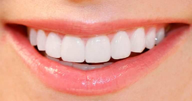 Use of active carbon to bleach the teeth