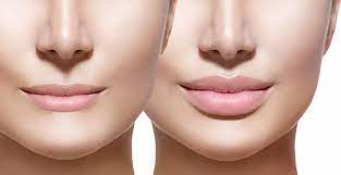 Why Do People Choose Cosmetic Procedures?