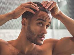How to Care For Thinning Hair